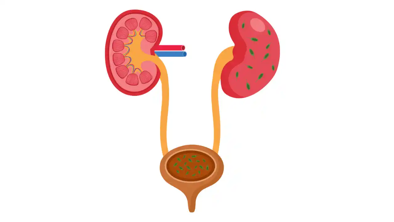 Urinary & Kidney Disease Herbal Remedies | پیشاب اور گردوں کی امراض کی ہربل ریمیڈیز